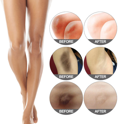 Fade Elbow Knee Joint Black Exfoliating Whitening Skin Beauty