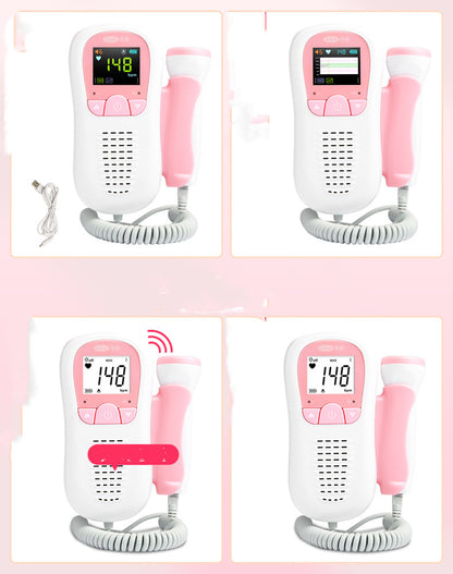 Corfu Doppler Fetal Favorite