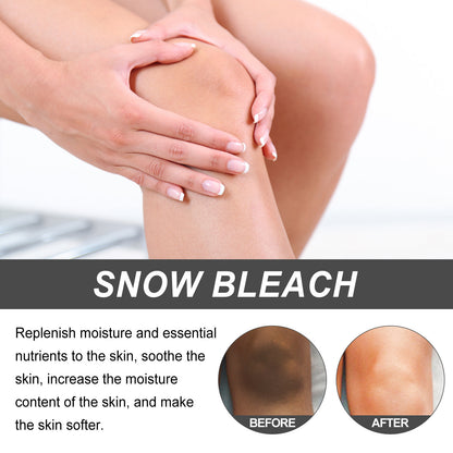 Fade Elbow Knee Joint Black Exfoliating Whitening Skin Beauty