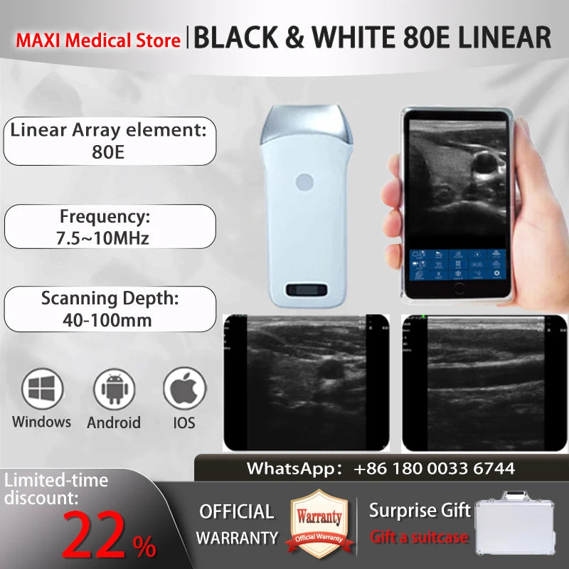 Scanner de sonde à ultrasons sans fil Portable, scanner à ultrasons WIFI, prise en charge de la valise gratuite iOS Android Windows