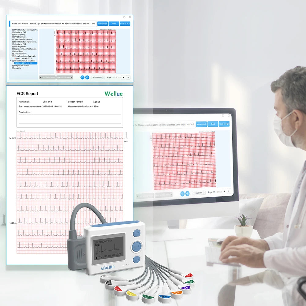 Moniteur Holter à 12 fils, enregistreur, surveillance continue 24 heures sur 24, dispositif ECG et fréquence cardiaque, moniteur d'électrode ECG, stockage de données